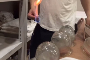 嘗試東方神秘力量！北京男籃外援斯佩爾曼曬拔火罐視頻