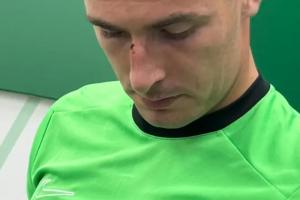 VAR介入不犯規(guī)！佩尼亞和維尼修斯相撞+遭絕平，賽后鼻梁留下傷痕